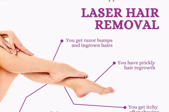 Laser Hair Removal before and after